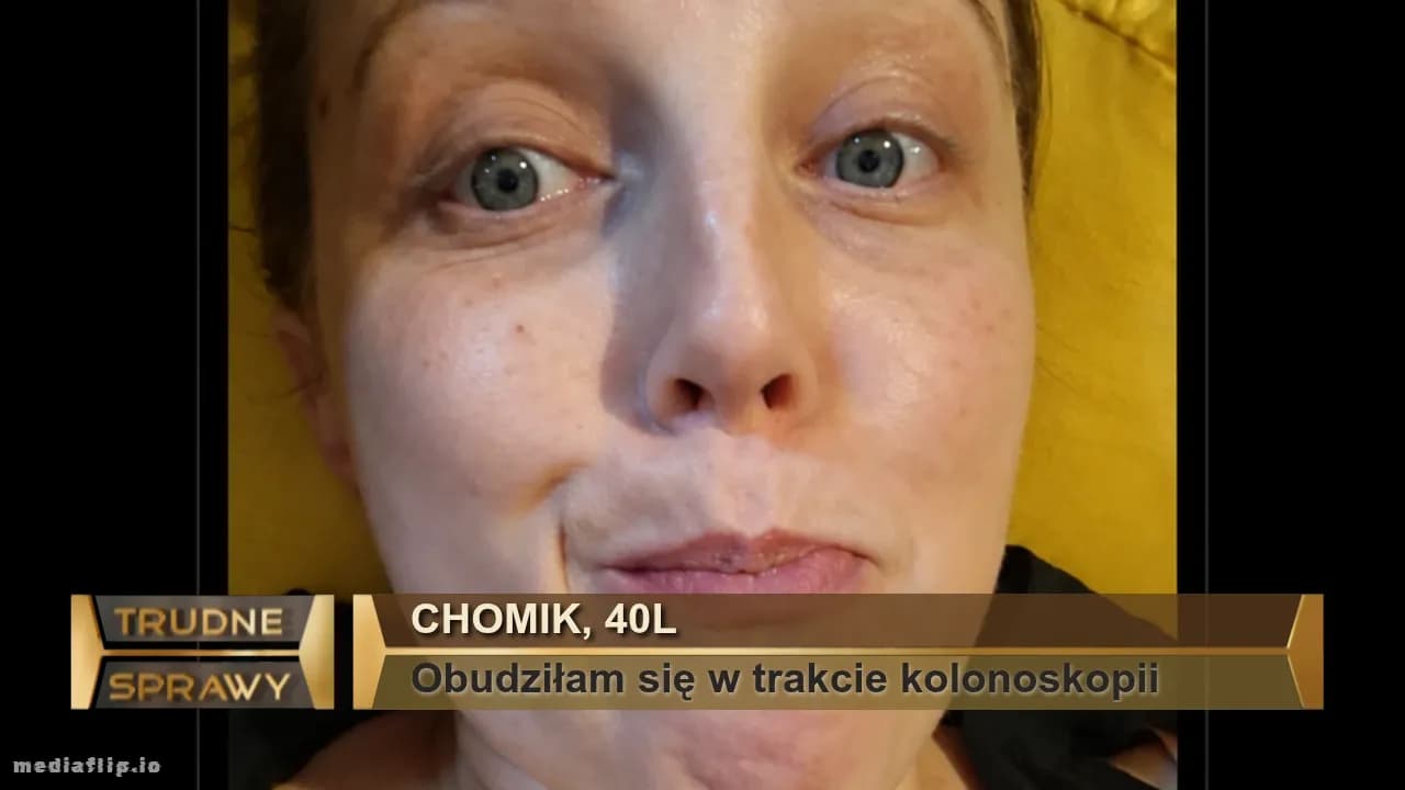 Chomik, 40l
Obudziłam się w trakcie kolonoskopii 